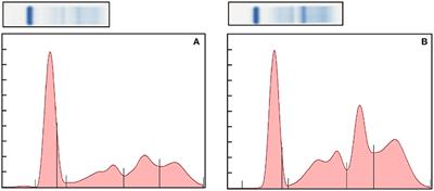 Protein Electrophoresis and Haptoglobin Values for Captive Bongo (Tragelaphus eurycerus)
